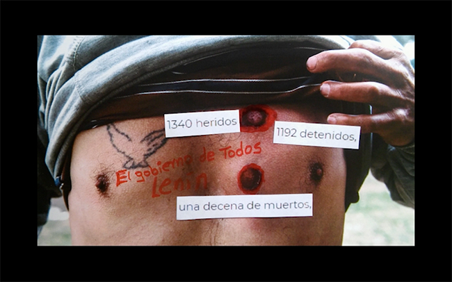 Figura 16. La imagen-montaje como interconexión del torso de un manifestante herido y las etiquetas textuales del número de detenidos, heridos y muertos
